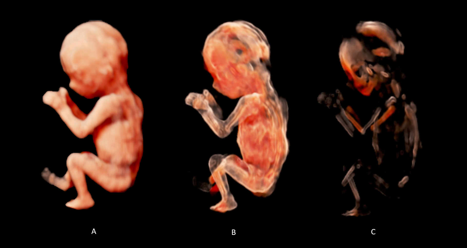 The 3D Ultrasound Atlas Website is online!