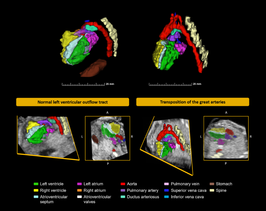 Expanding our 3D ultrasound imaging research