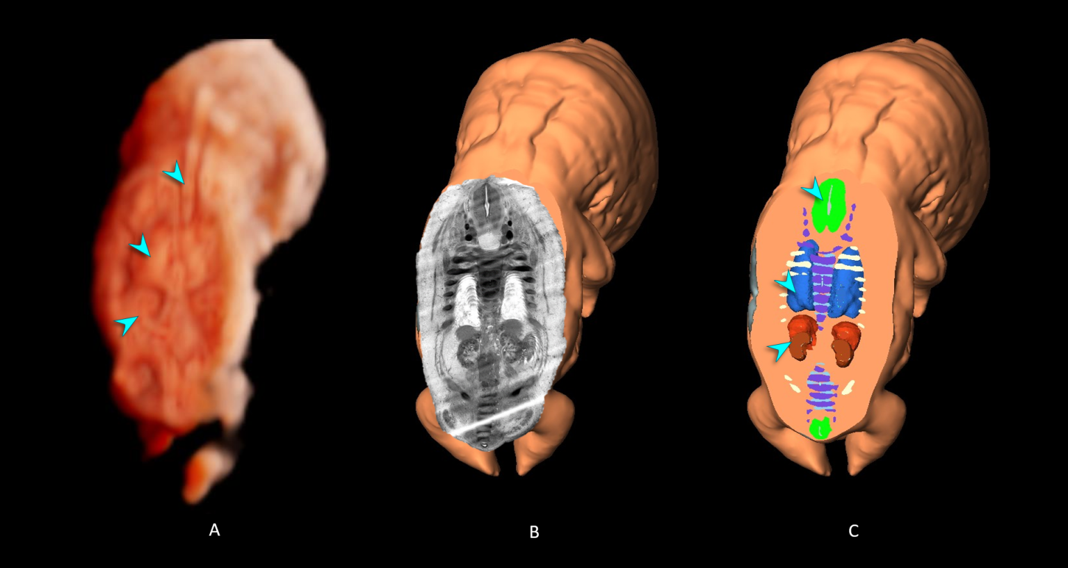 8 Weeks Gestation - 3D Human Development