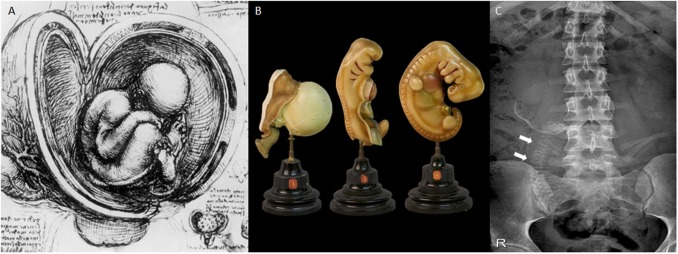 Review Imaging Fetal Anatomy