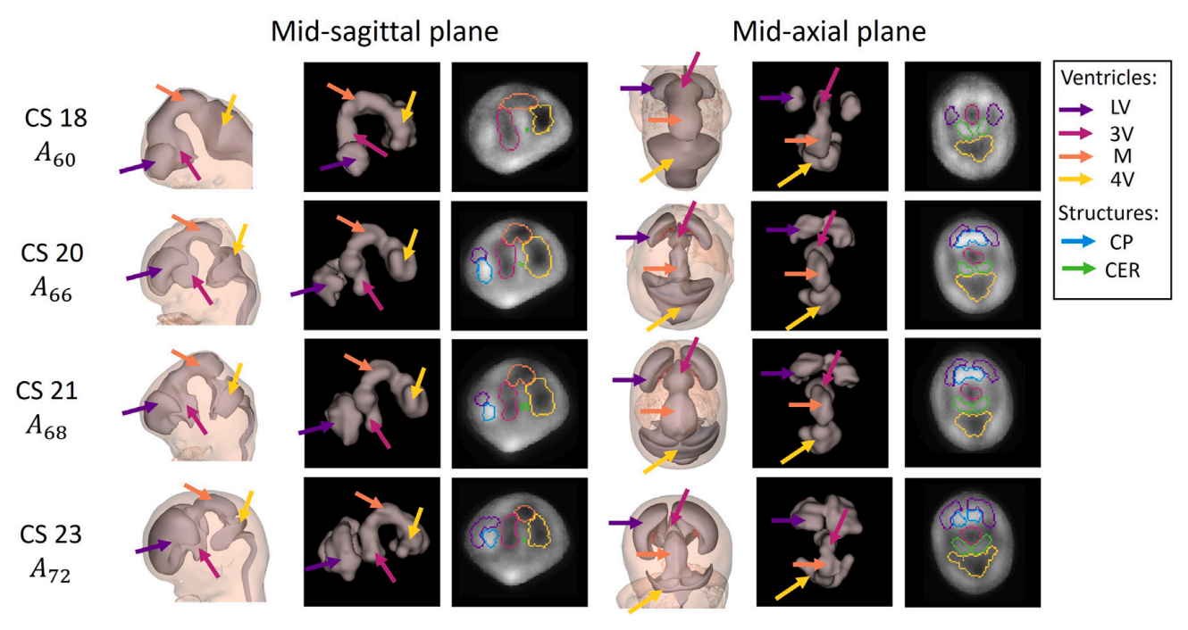 The 4D Embryonic Brain Atlas