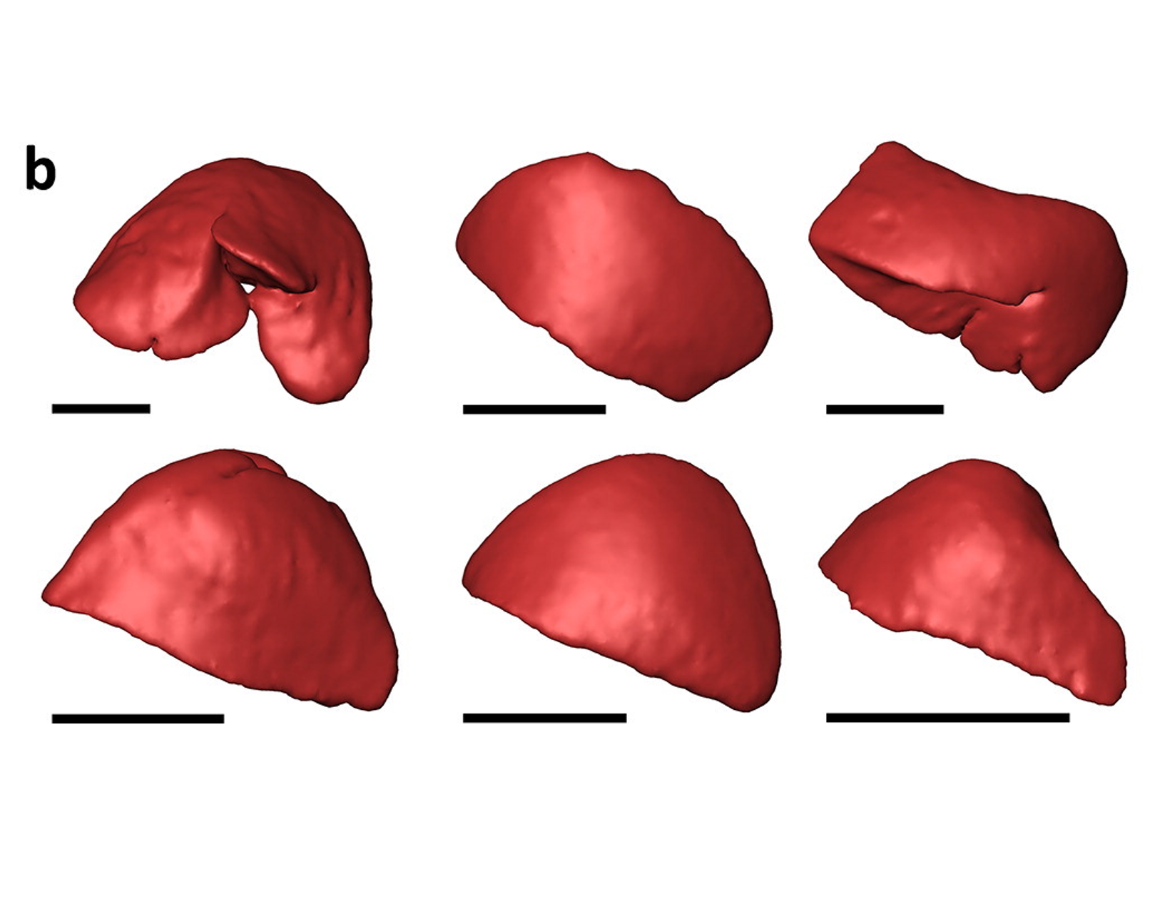 No evidence for Foetal Lobulation of the Spleen